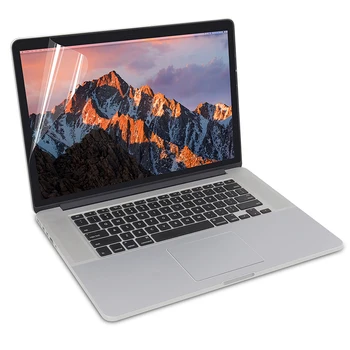 Za celotno Telo, Kožo za MacBook Pro 15-inch A1398 model, Vključujejo Vrh + Bottom + Sledilna ploščica + Naslon za roke, Kožo + Screen Protector